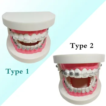 1 Gabalas Dantų Ortodontinis Dantų Modelio Metalas/Keramika Skliaustuose Kontrastas Adelomorphic Ligatura Kaklaraištis Burnos Vamzdelis NiTi Archwire